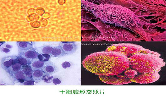 干细胞转化研究
